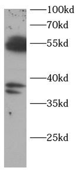 CASP8 Antibody
