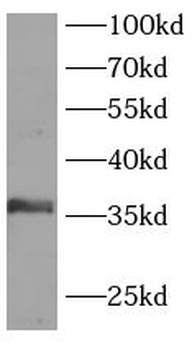 LAT Rabbit Polyclonal Antibody
