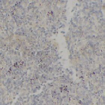 LAT Rabbit Polyclonal Antibody