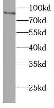 FES Rabbit Polyclonal Antibody