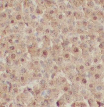FES Rabbit Polyclonal Antibody