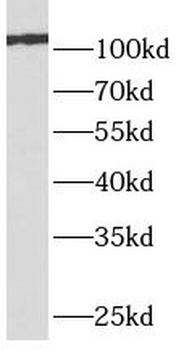 GRM4 Antibody