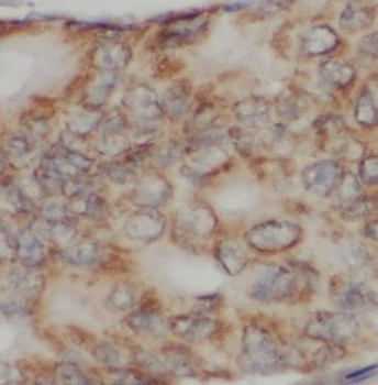 CX3CR1 Antibody