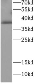 KLF2 Rabbit Polyclonal Antibody
