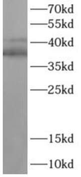 TAL1 Rabbit Polyclonal Antibody