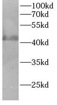 AURKA Antibody