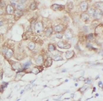 AURKA Antibody