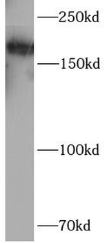 SMARCA4 Rabbit Polyclonal Antibody