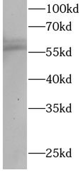 RORC Rabbit Polyclonal Antibody