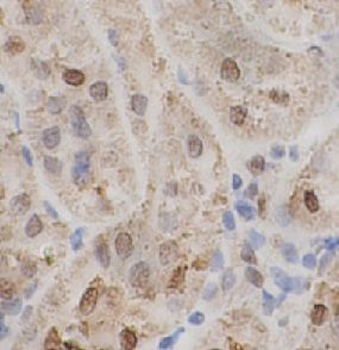 TARDBP Antibody