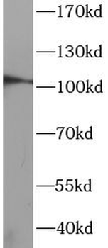 DDR1 Rabbit Polyclonal Antibody