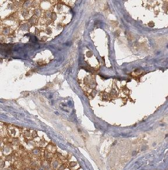 DDR1 Rabbit Polyclonal Antibody
