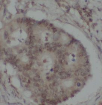 MTHFR Antibody