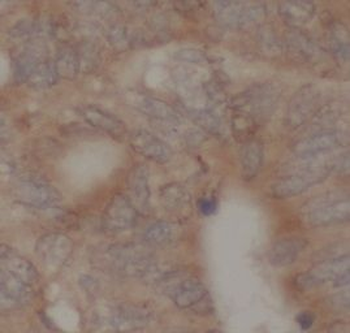 HMGCR Antibody