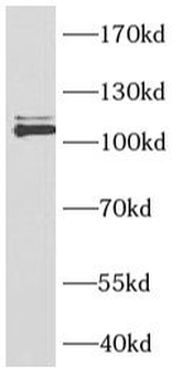 NCOR1 Antibody