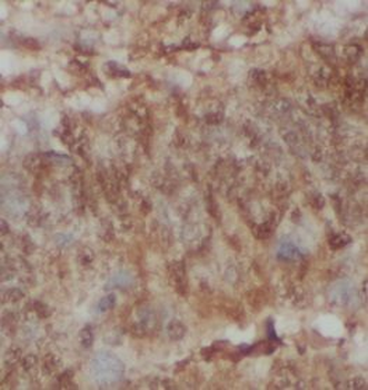 NCOR1 Antibody