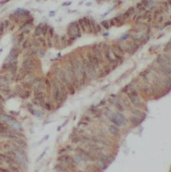 ABCA4 Rabbit Polyclonal Antibody