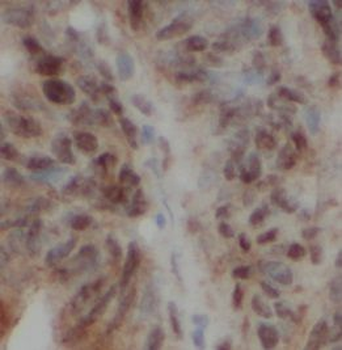 MED1 Antibody