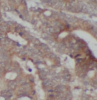 FGA Rabbit Polyclonal Antibody