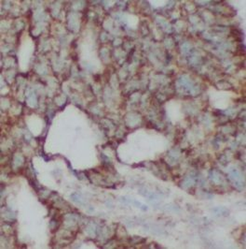 PMP22 Antibody