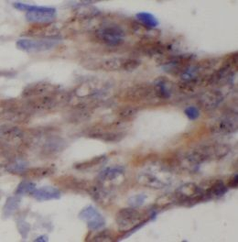 DNA2 Antibody