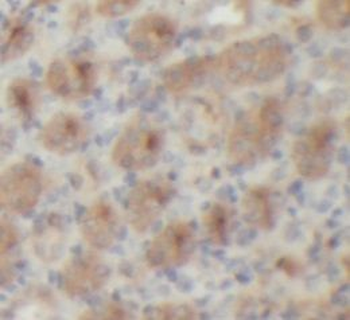 RECK Rabbit Polyclonal Antibody