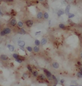 CD14 Rabbit Polyclonal Antibody