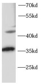 OTX2 Antibody
