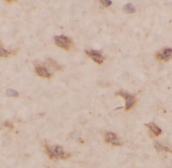 OTX2 Antibody