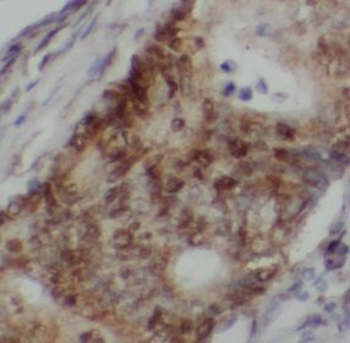 PTCH1 Antibody