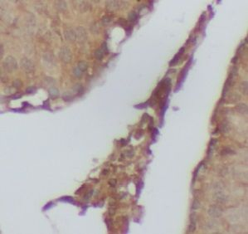 PRKN Antibody