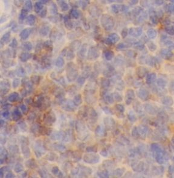 CD44 Rabbit Polyclonal Antibody