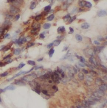 PRKCQ Rabbit Polyclonal Antibody