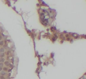 PLA2G4B Antibody
