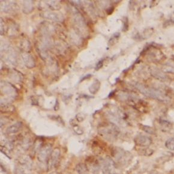 MGMT Antibody