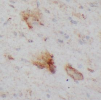 MED4 Antibody