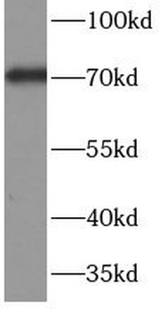 C9 Rabbit Polyclonal Antibody
