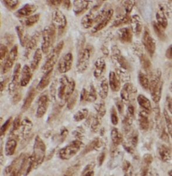 C9 Rabbit Polyclonal Antibody