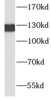 CDH1 Antibody