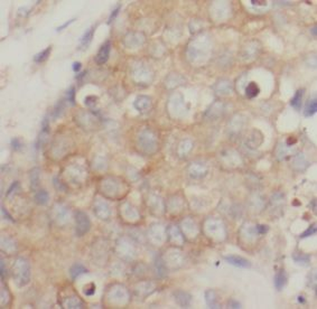 CDH1 Antibody
