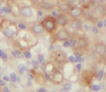 MTNR1B Antibody