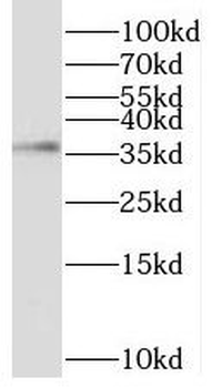 TNNT2 Rabbit Polyclonal Antibody