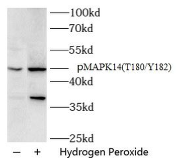 Phospho-MAPK14 (T180/Y182) Antibody