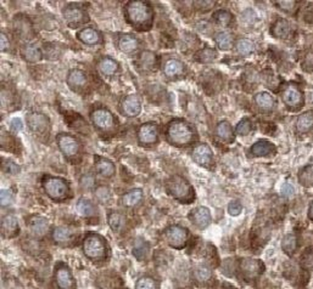 TAU Mouse Monoclonal Antibody