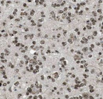 PLCB1 Antibody