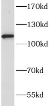 NLRP3 Rabbit Polyclonal Antibody