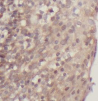 CD200 Rabbit Polyclonal Antibody