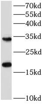 EIF4EBP1 Rabbit Polyclonal Antibody
