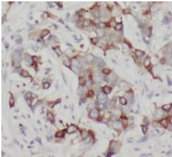 EIF4EBP1 Rabbit Polyclonal Antibody