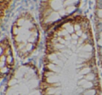 PDGFA Rabbit Polyclonal Antibody